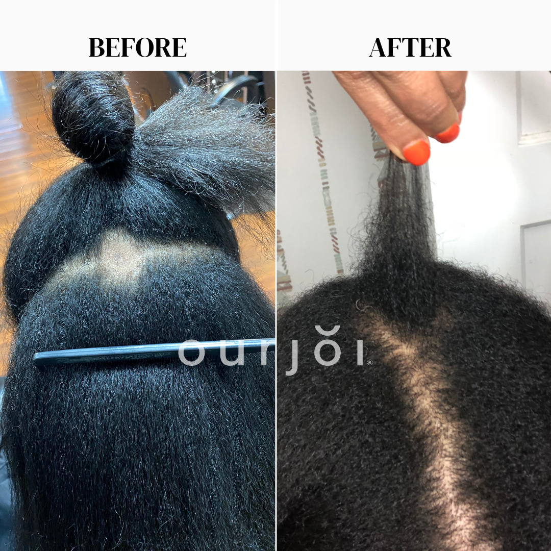 Stimulating Hair Oil